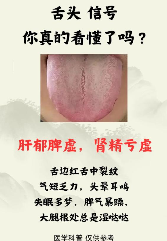 舌象辨证：3 种脏腑失调的表现与调理