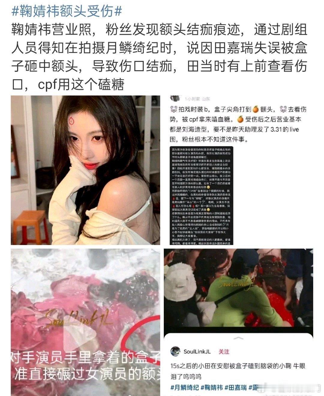 鞠婧仪额头上的疤痕是田嘉瑞弄的[疑问]这是真的假的？ ​​​