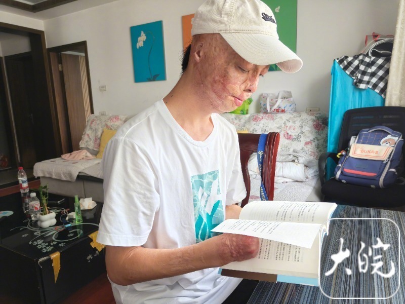 【祝贺！#烧伤男孩方益凡被东南大学录取#】7月26日深夜，池州烧伤男孩方益凡查到