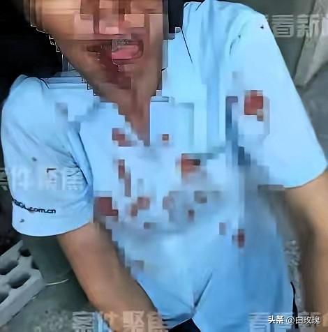 上海，一外甥带5人上门，对舅舅进行围殴，舅妈激愤之下，拿起一瓶强腐蚀性液体，直接