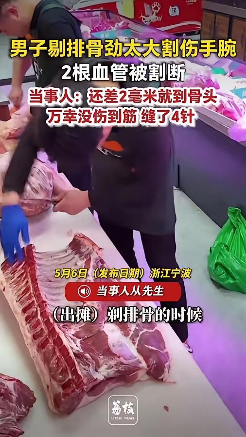 人到了中年再看宁波摊主剔骨伤手这一幕，
蕞大的心酸，
是我们拼尽全力捧着饭碗，