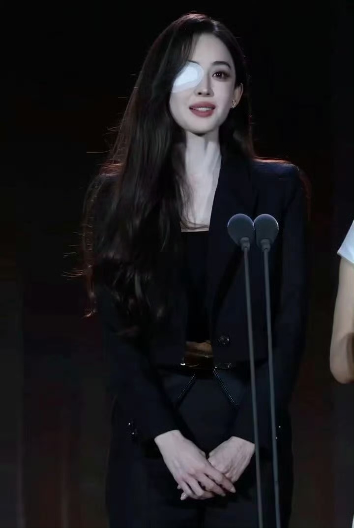 娜扎右眼贴纱布绝对美貌下眼贴都是时尚单品娜扎因工作强度过大，眼睛过敏了，所以贴着