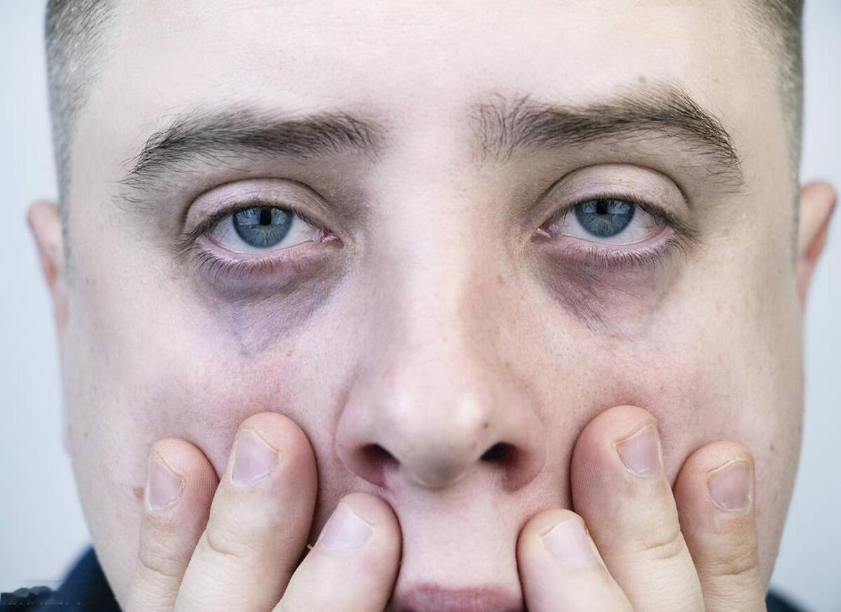 这4种脸色可以看出你身体情况代表大病将至，别等问题出现才看！

1、眼圈发黑

