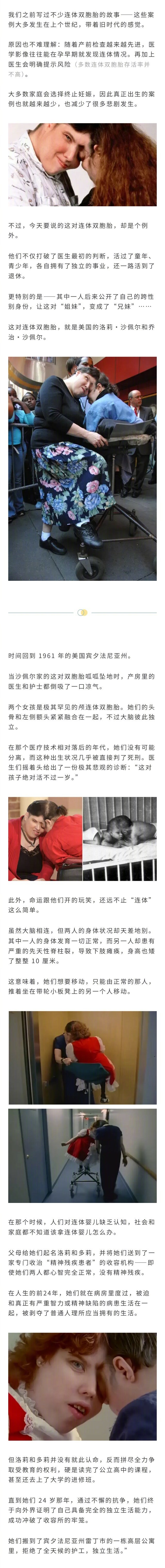 连体双胞胎姐妹打破医生悲观预测活到62岁，其中一人成为保龄球冠军，还有一个人变性