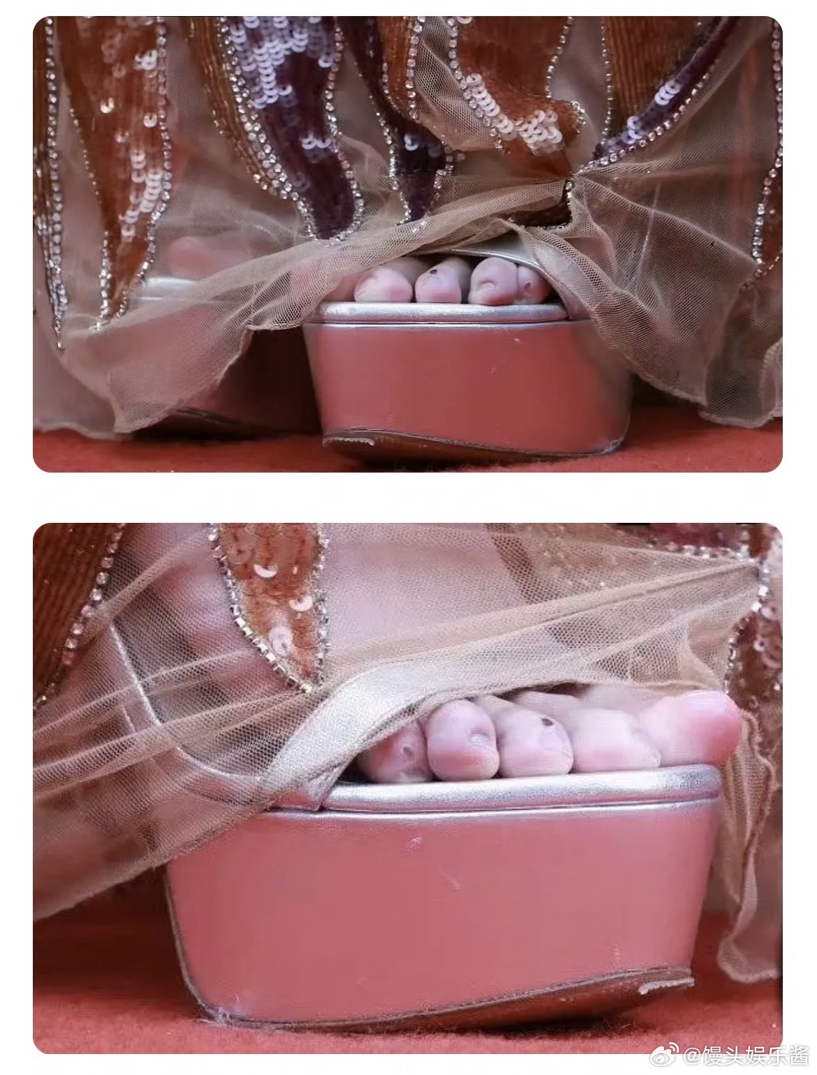 陈都灵的脚是受伤了吗 