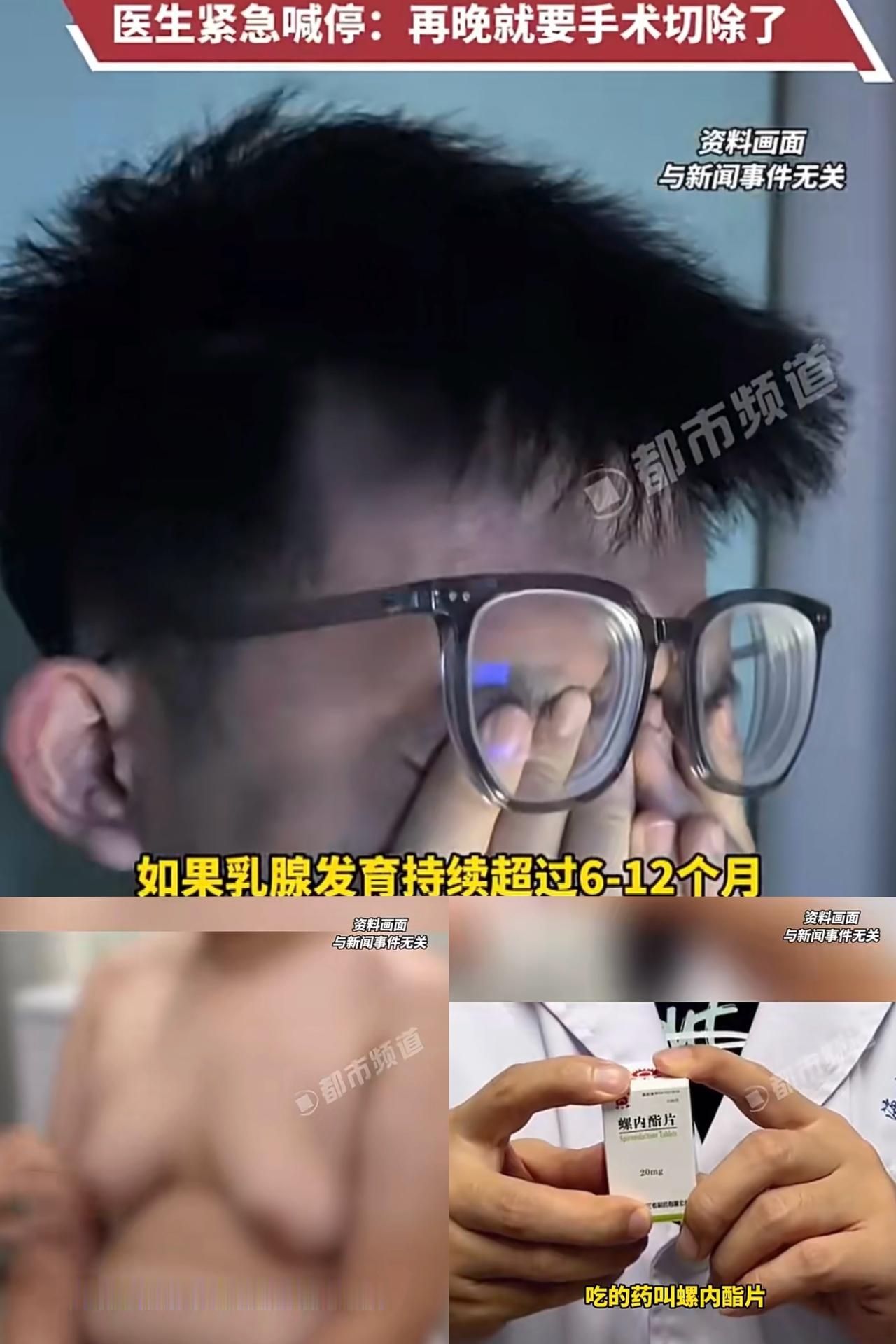 一觉醒来，相信长青春痘的孩子们再也不敢乱吃激素药了！近日，浙江一名高二的男孩子，