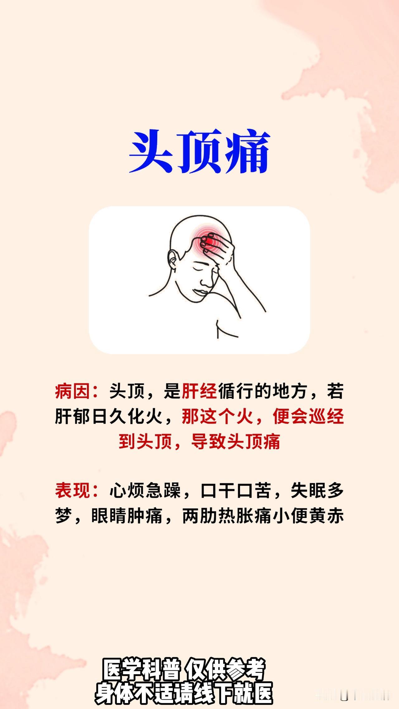 不同部位的头痛，都代表什么问题？