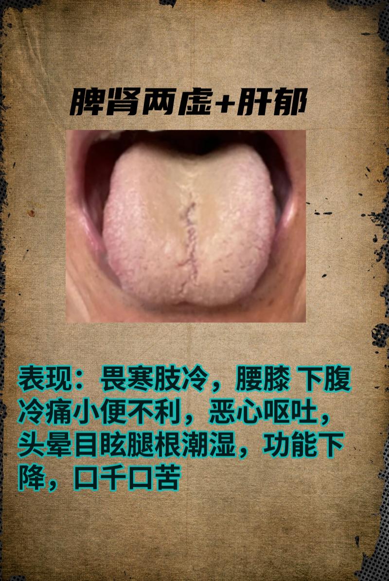 今日舌诊分享！

还是老规矩，你拍照，我分析，现场出结果！
#中医##舌诊##涨