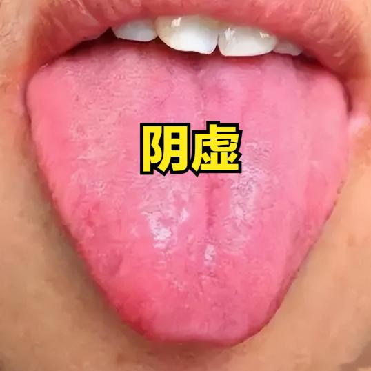 冬季干燥，送你四个滋阴生津的中成药，助你补足一身阴津！
 
1、大补阴芄——滋阴