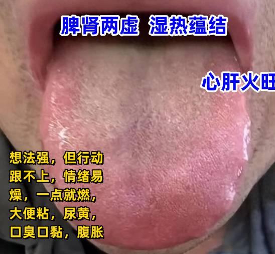 今日舌诊案例分析，每天学习一点，看着看着就会了[给力][给力][给力]