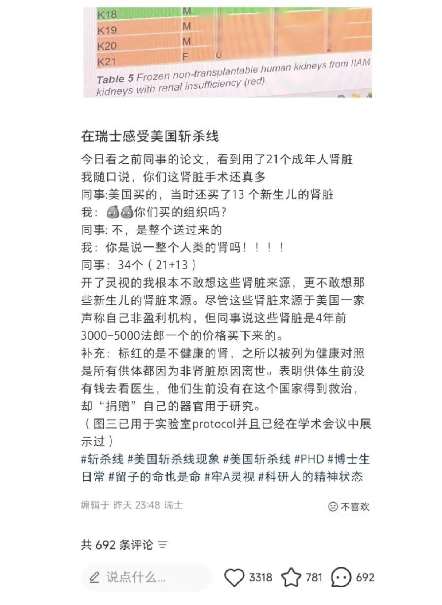 一名在瑞士工作的医生也感受到了“斩杀线”。。瑞士医院从美国购买的13个新生儿肾源