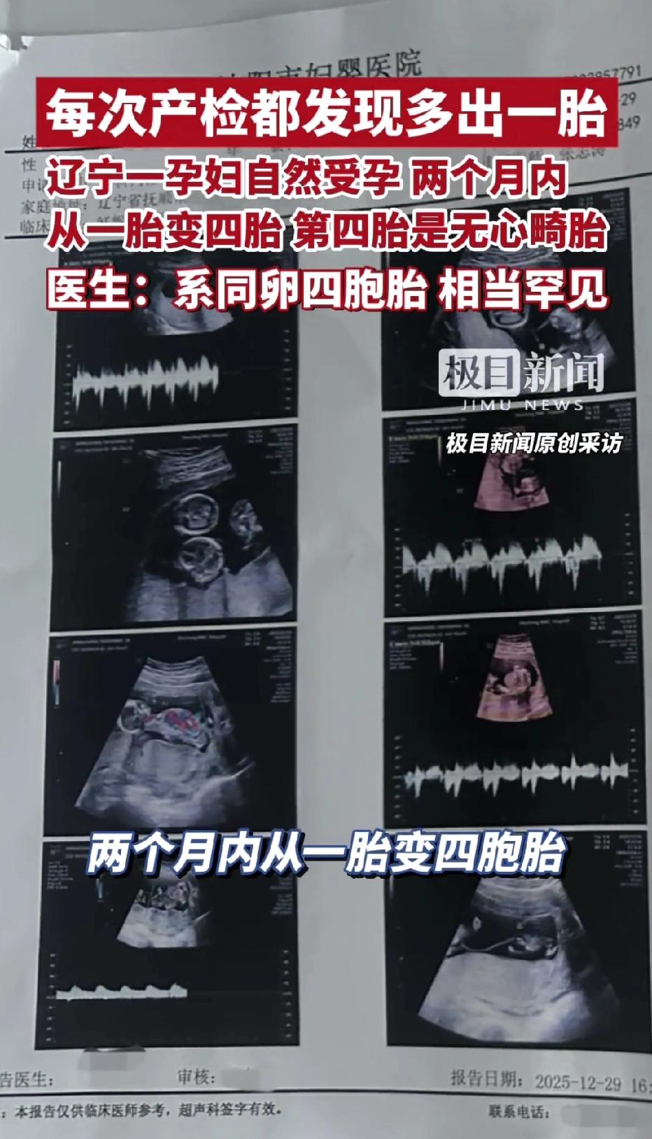 辽宁抚顺，一位30岁女子自然受孕后去医院产检，结果却发现，每一次产检胎儿都会多一