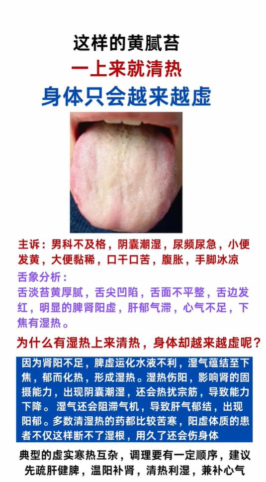 这类黄腻苔别乱清热，海绵体状态会越来越差