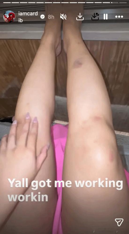 Cardi B演唱会摔惨了Cardi B在拉斯维加斯举办的“Little Mis