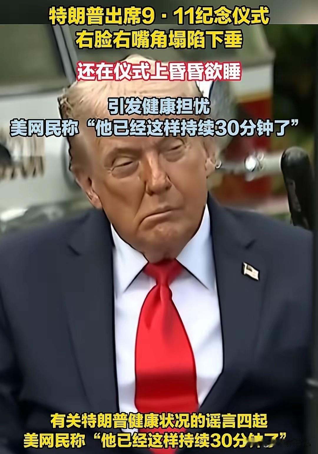 老特这是中风了！？
刚才刷新闻，看到这张照片，给我吓一跳，还以为他中风了呢，他这