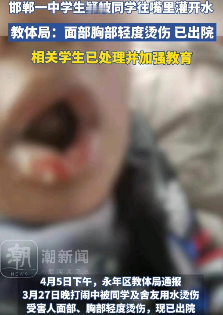 河北邯郸，一名中学生被两名同学往嘴里灌开水。这名学生的面部和胸部轻度烫伤，经过住
