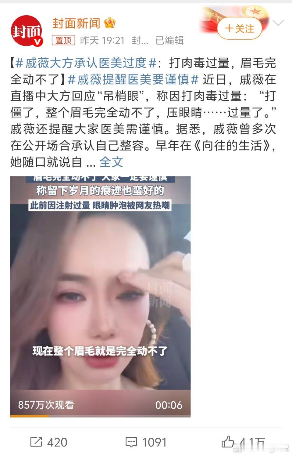 戚薇大方承认医美过度她真的很大方有什么就分享不会一直在说自己没动过[允悲][允悲