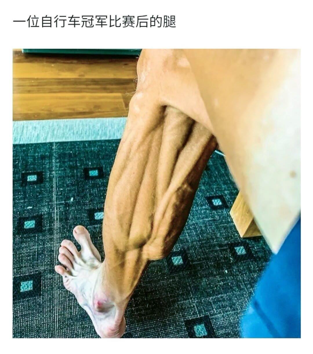 为什么运动员的腿会变成这样？