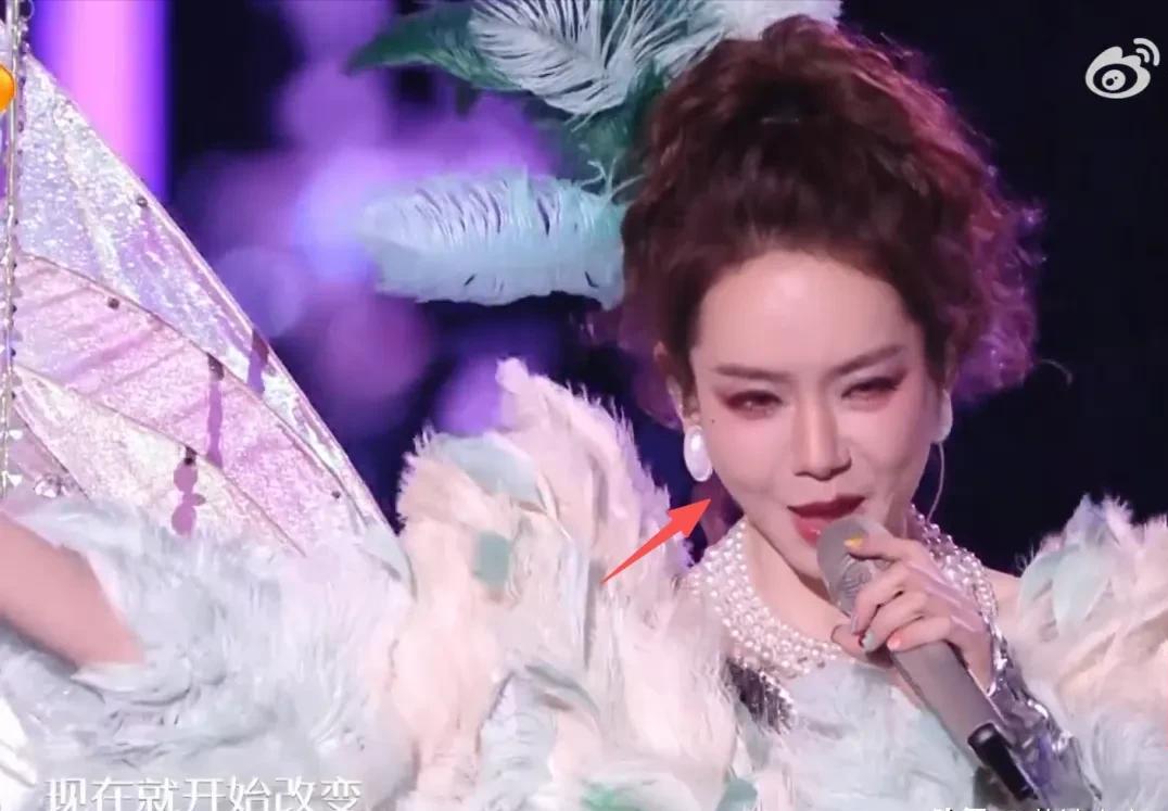 跨年夜最尴尬的三位女明星

第一位：戚薇

脸变形了，时间没安排到位，还没消肿就