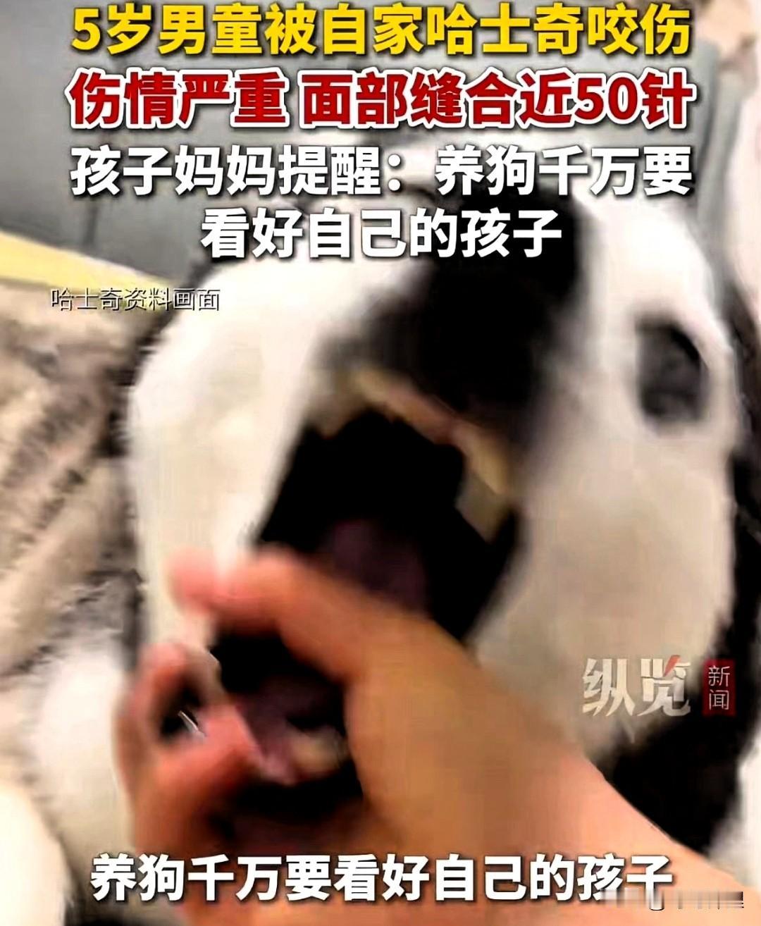 还说我家狗不咬人？这下那些把狗当祖宗供着的人，该彻底没话说了吧。

近日江苏徐州