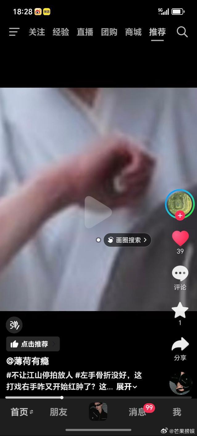 杨洋杨洋手部又受伤了杨洋在不让江山剧组又受伤了这就是剧组的好好照顾《谨遵医嘱并合