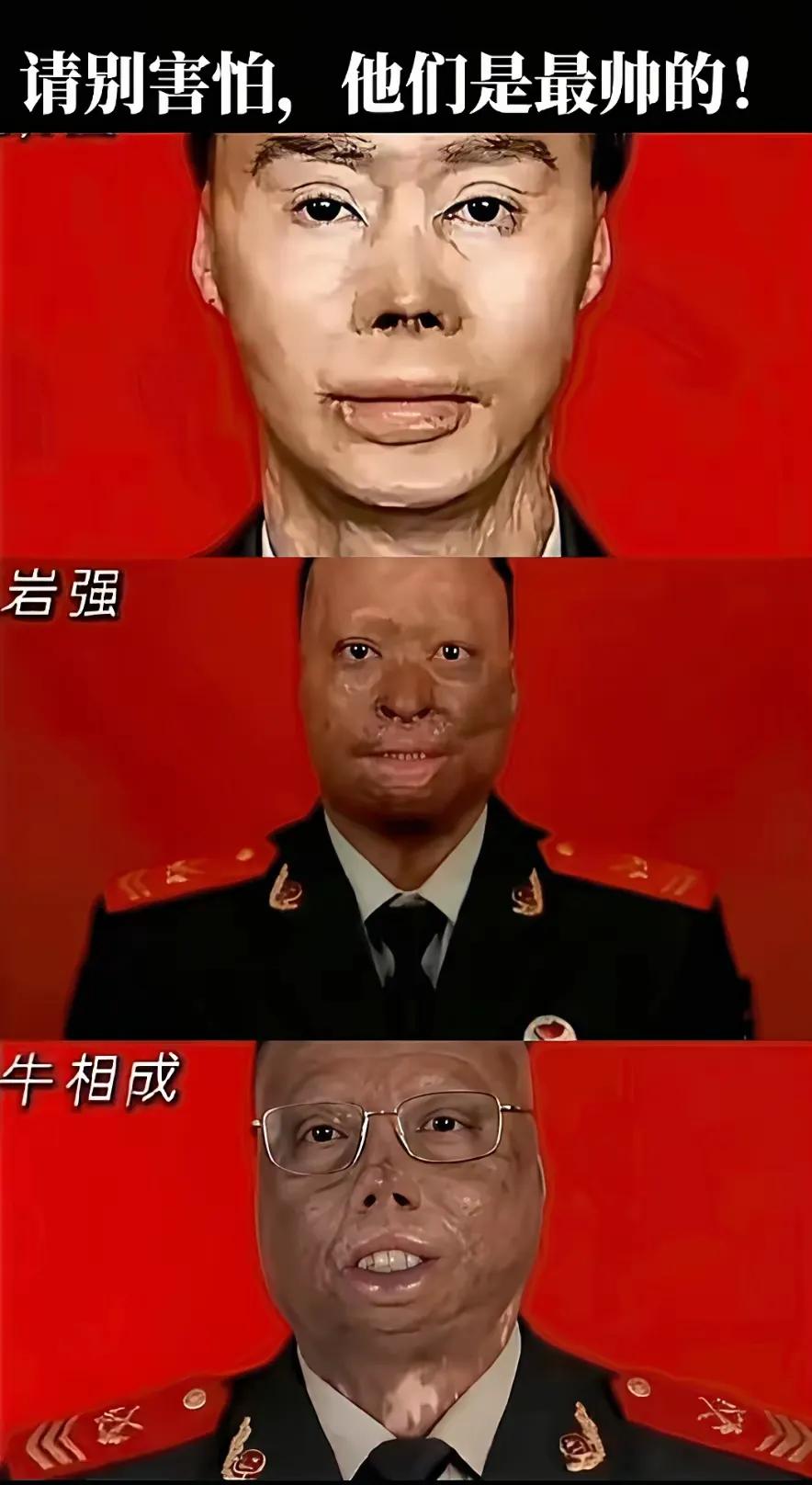 致敬英雄，无论他们容颜受损成什么样，在人民心中永远都是高大威猛，英姿飒爽！