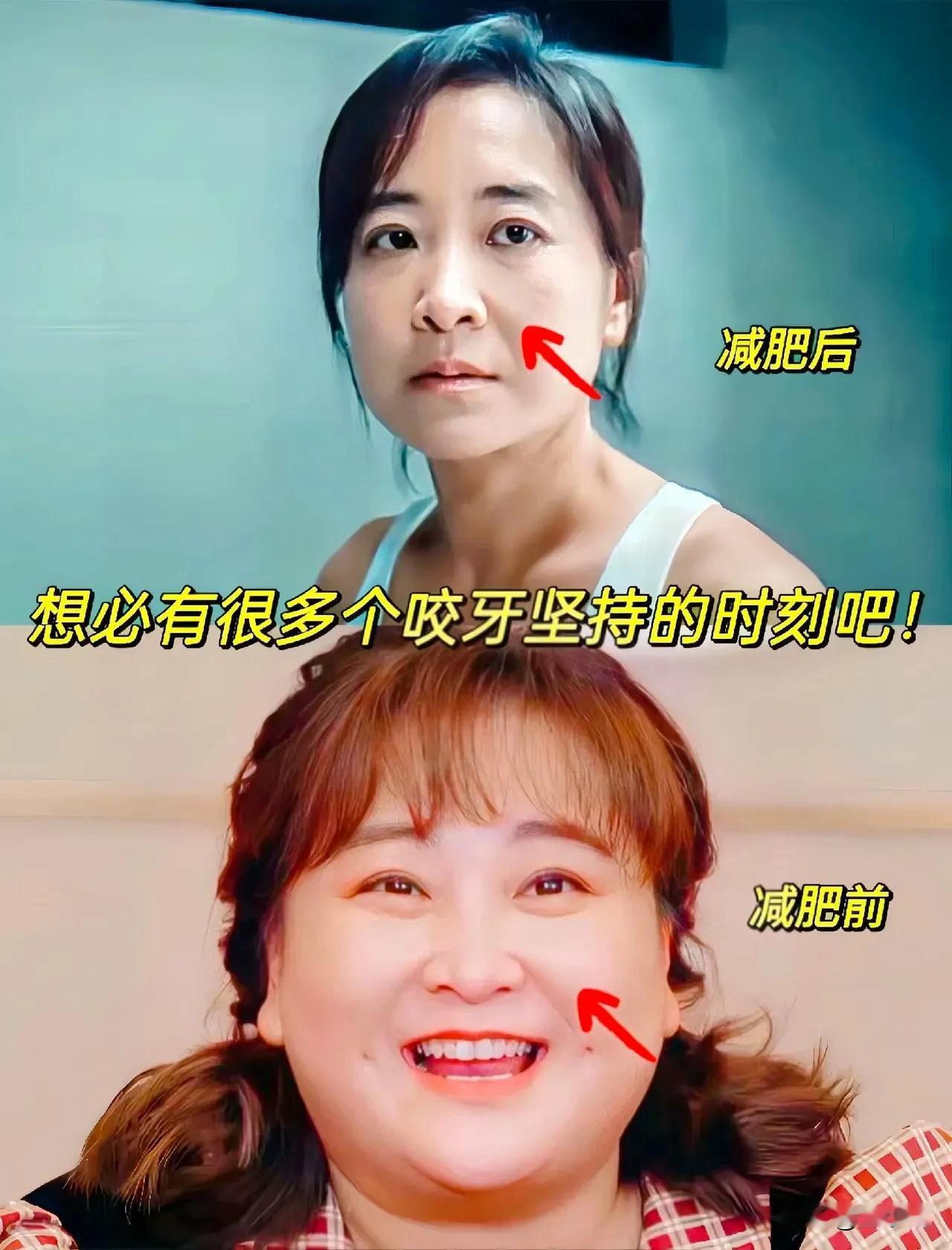 你喜欢减肥后的贾玲，还是减肥前的贾玲？
个人觉得减肥后的贾玲显老，法令纹都出来了