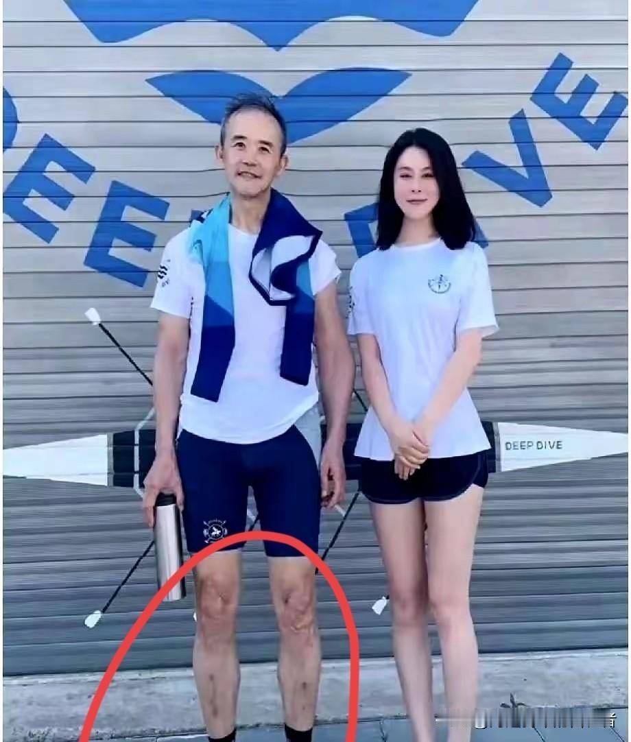 一个75岁的老人，腿上全是伤，好多人在看，这是怎么回事，大家都觉得不可思议，极限