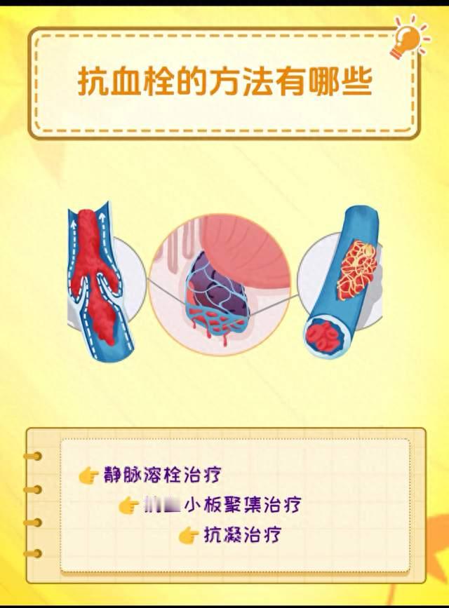 氯吡格雷与利伐沙班：两种抗栓常用药，千万别吃混了