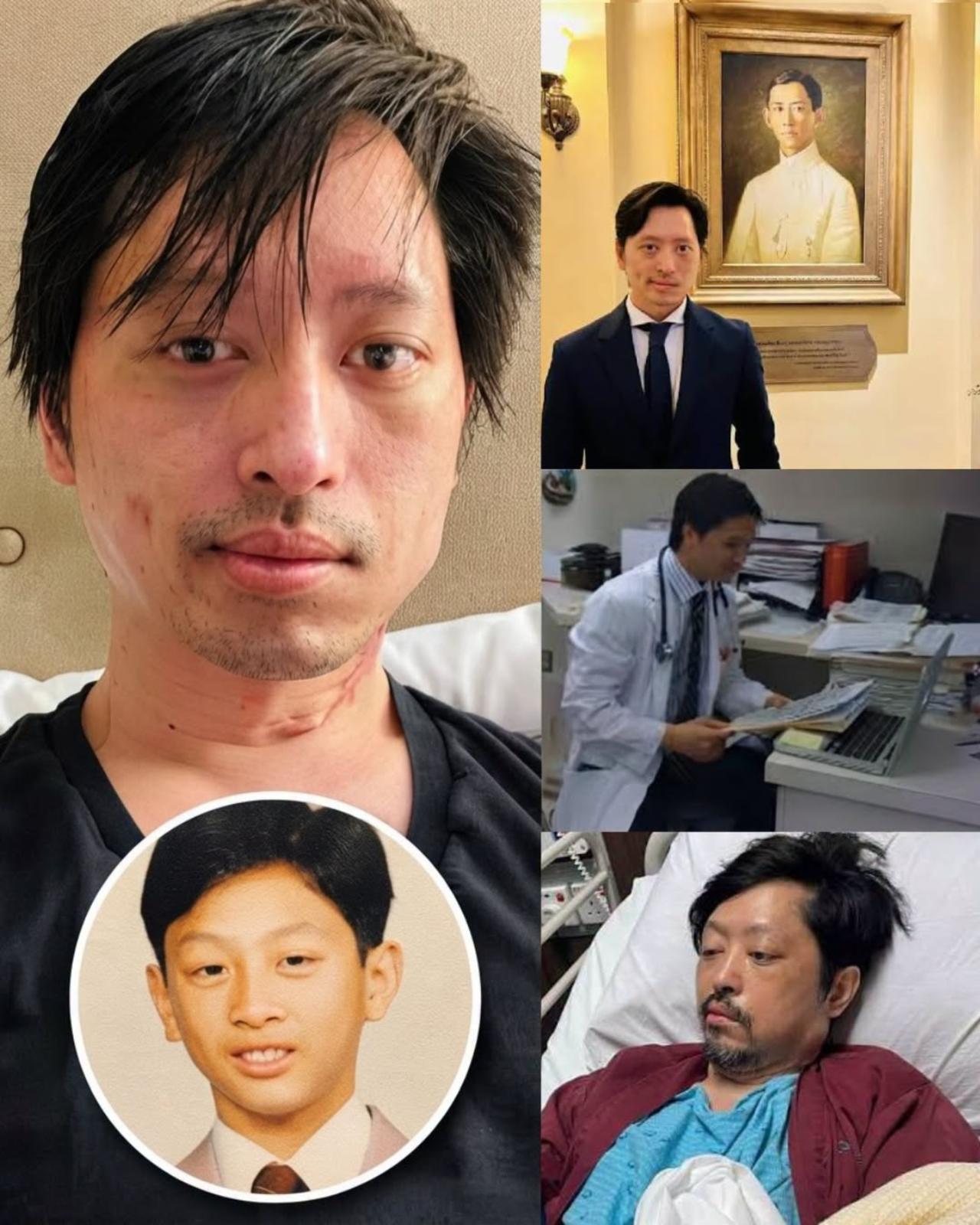 泰国三王子原本很帅，被病痛折磨得变了样
泰国三王子Than Ong从小就不是个"