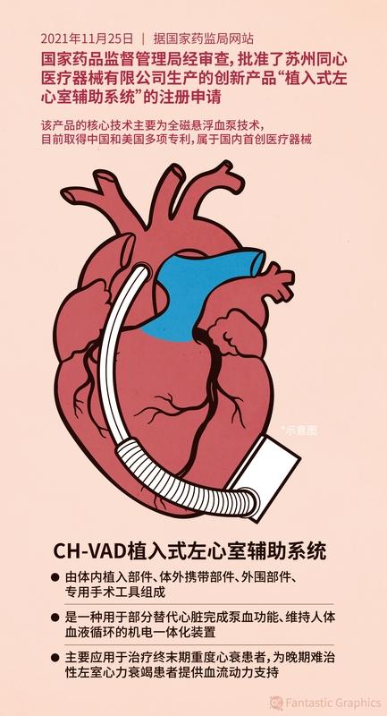 中国研究团队发现GLP-1类药物治疗心衰潜力在医学研究领域，这一发现宛如一颗璀璨