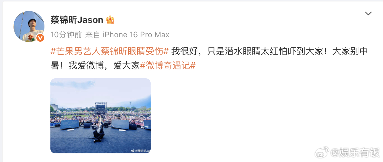 蔡锦昕回应眼睛受伤 回应 芒果男艺人蔡锦昕眼睛受伤 ，表示自己只是潜水眼睛太红怕