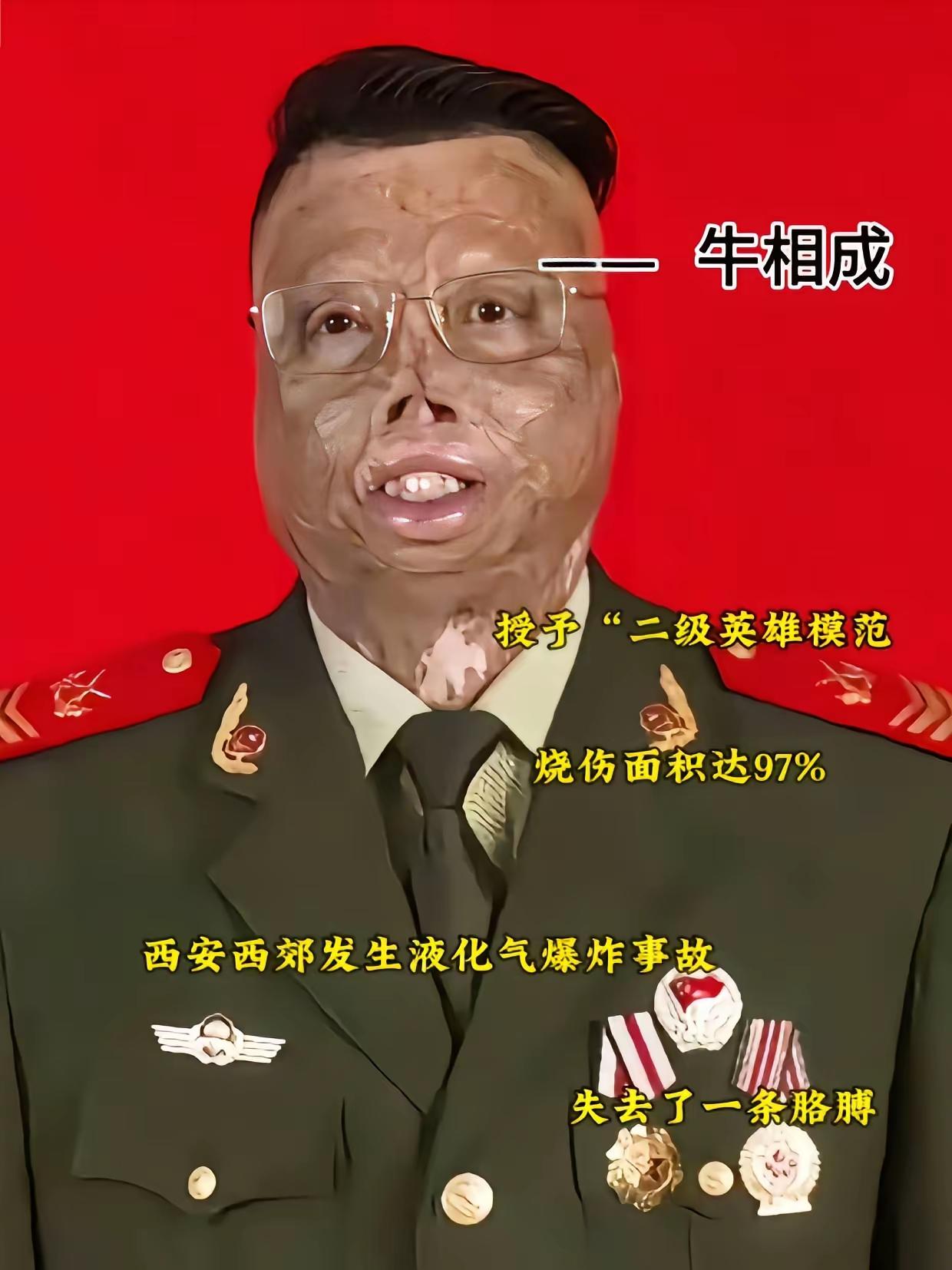 全身97%烧伤、失去一条手臂，荣立一等功、全国公安二级英模；牛相成，甘肃庆阳人，