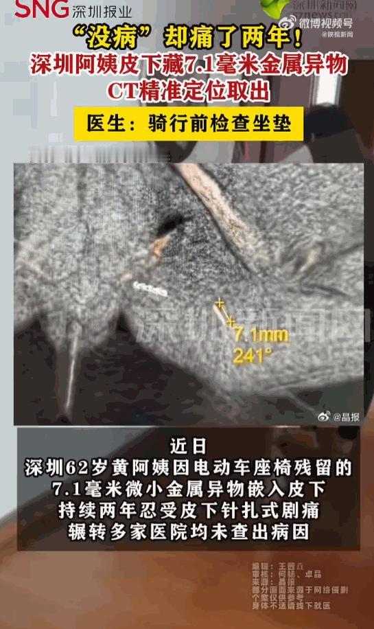 深圳62岁黄阿姨被隐私部位针扎般剧痛折磨两年，多家医院查无器质性问题，一度被判为
