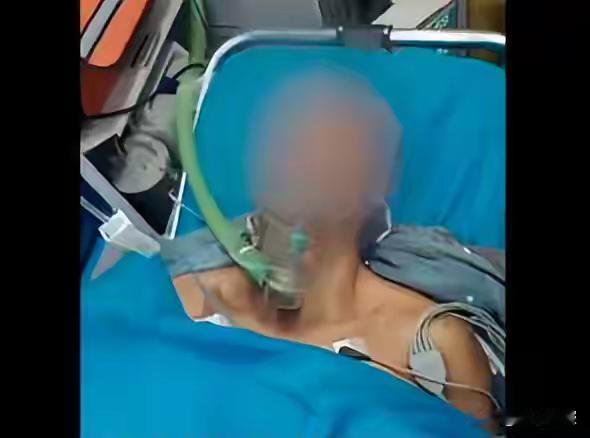 男子夜晚钓鱼被枪击致重伤，家属：4名打猎者误以为他是猎物


湖南南县一名男子晚