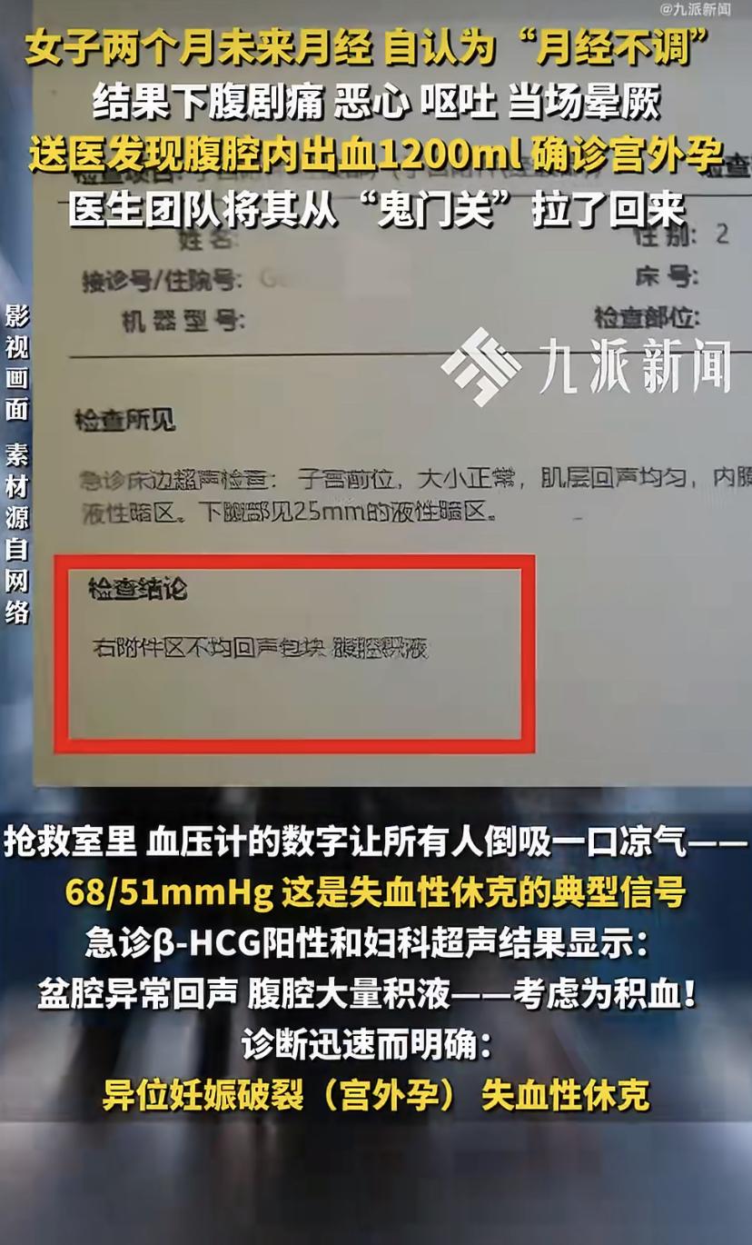 41岁女子月经紊乱俩月没当回事，结果宫外孕大出血
1200ml!医生：再晚半小时