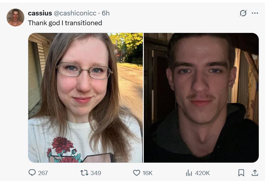 一位跨性别男网红发了自己的对比照。
天呐，这是真的吗？变化也太大了吧！