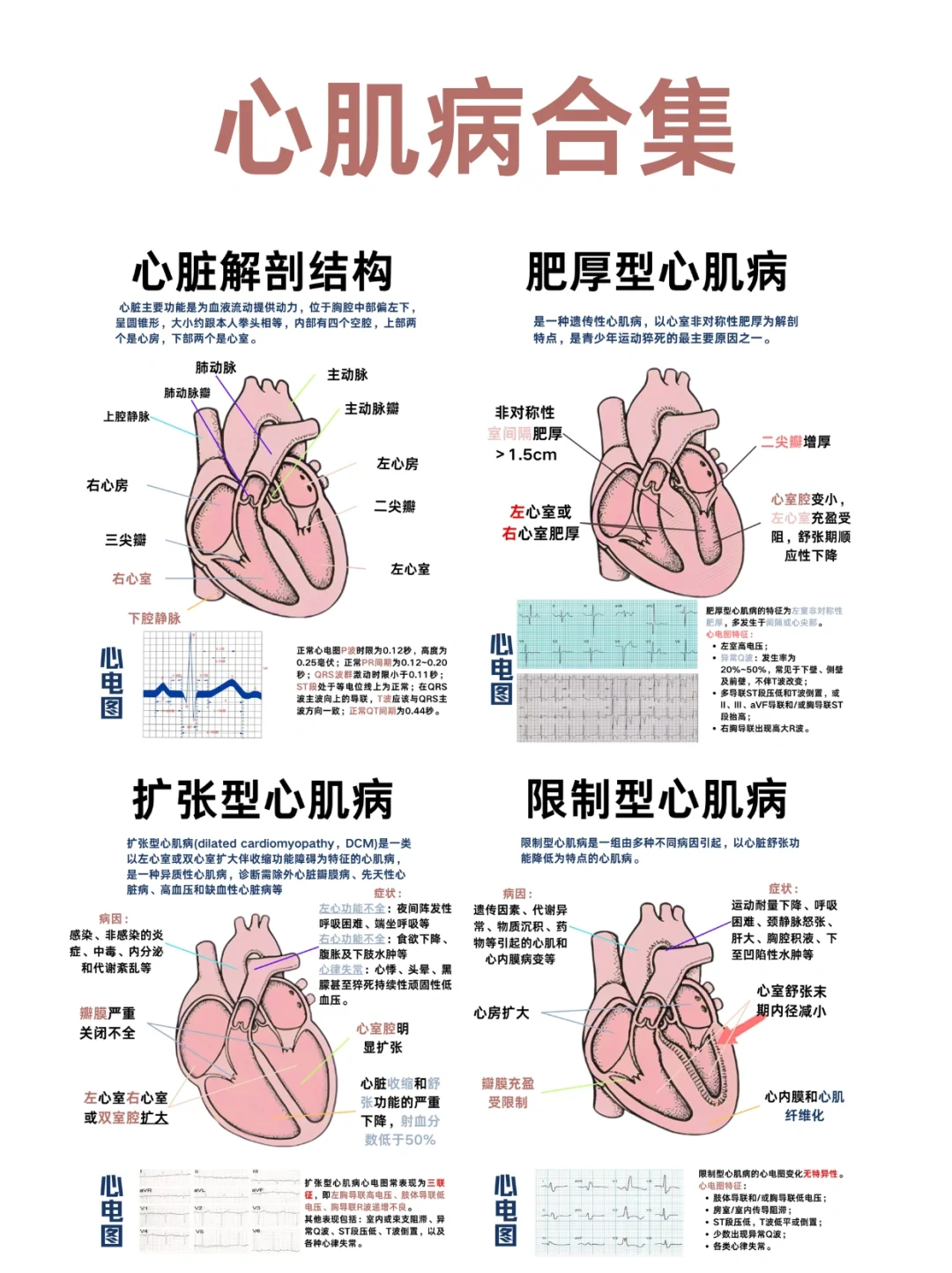 医学生笔记——心肌病合集