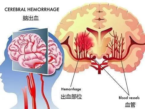 我妈跟我说:你打电话问了吗？现在情况怎么样了？

我说:我不好意思问啊，我也很害