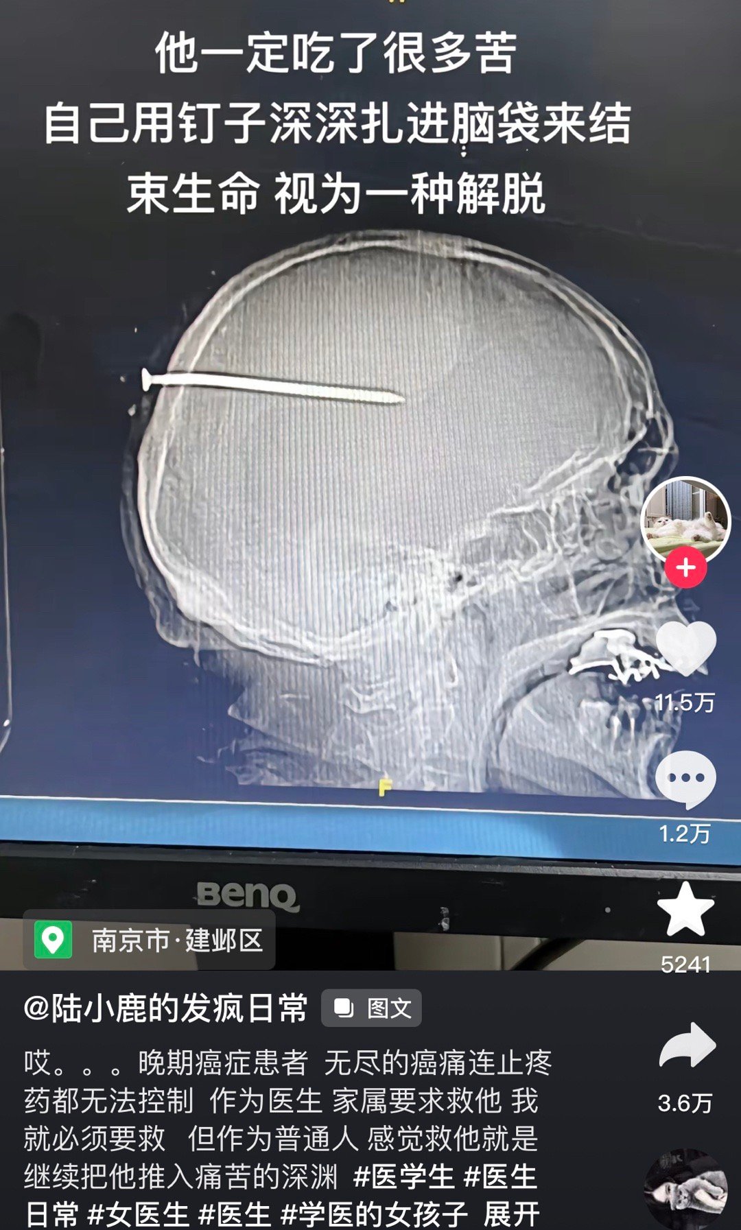 是有多痛苦才用这么残忍的方式结束自己的生命[泪]冲击力太强了 ​​​
