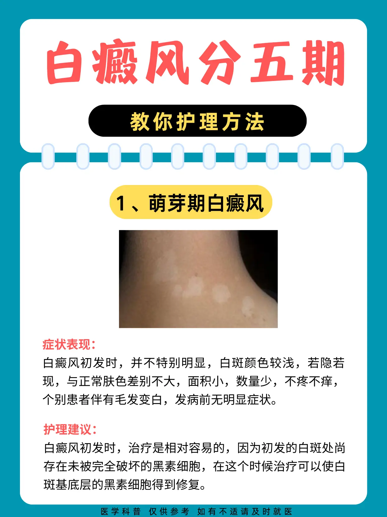 医学科普 白癜风 白癜风科普 硬核健康科普行动  白斑