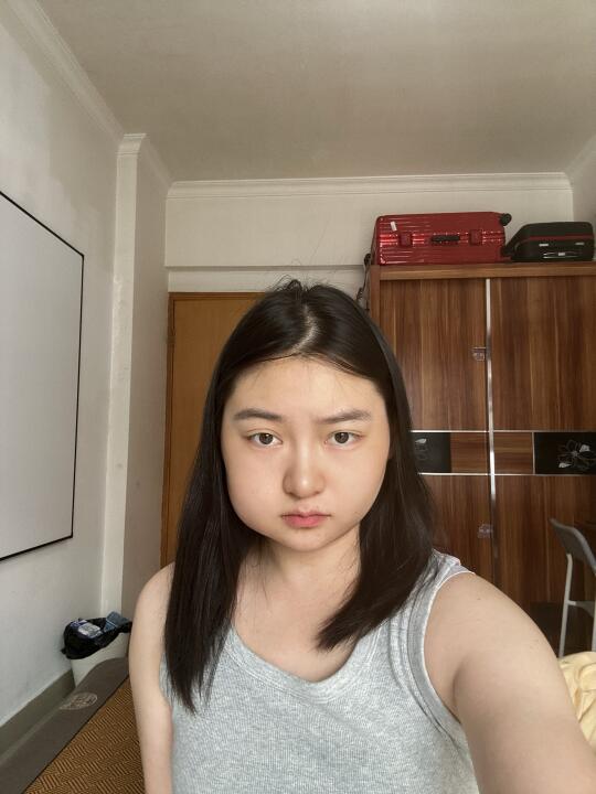 拔牙第二天脸肿了上班怎么面对同事