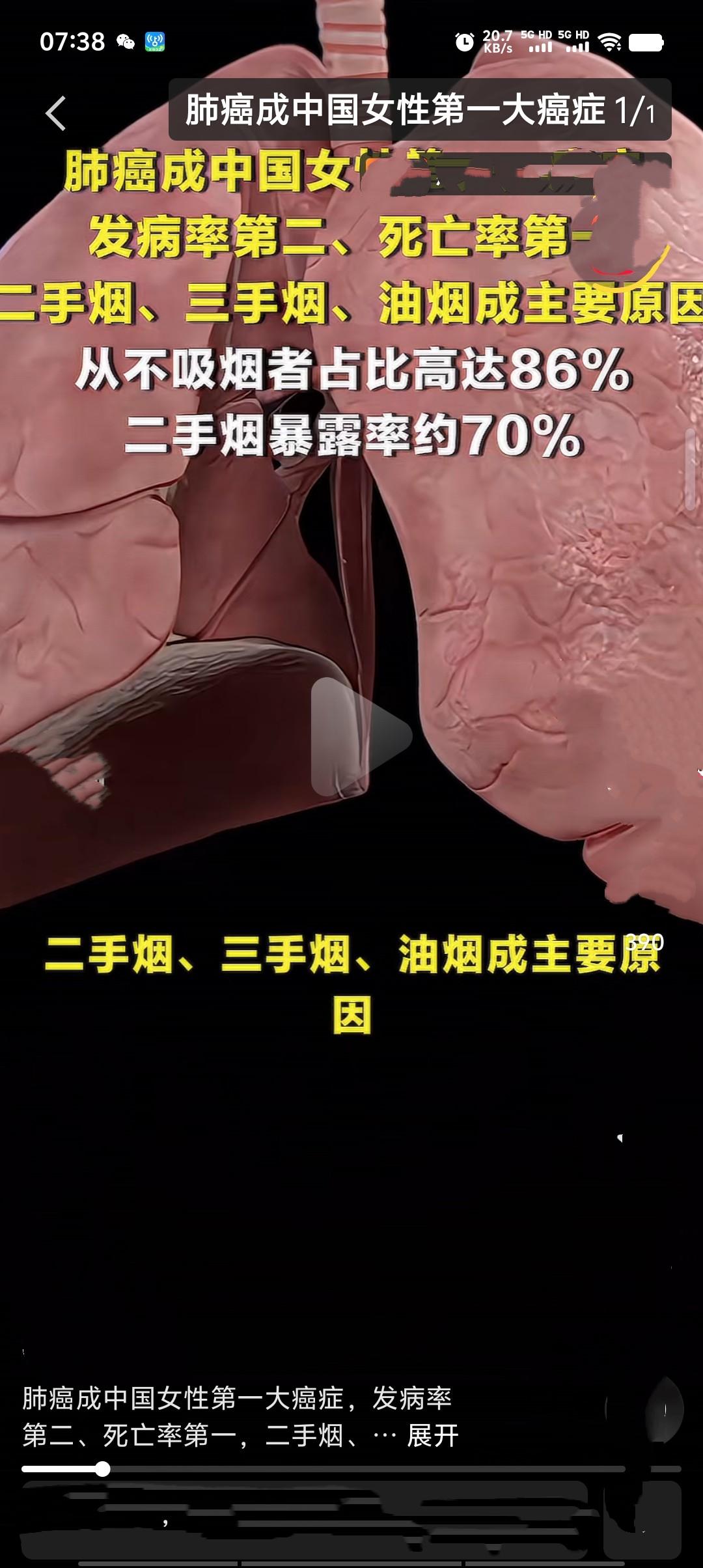 据2024年国家癌症中心数据，肺癌已超越乳腺癌成为中国女性第一大癌种。我国女性肺