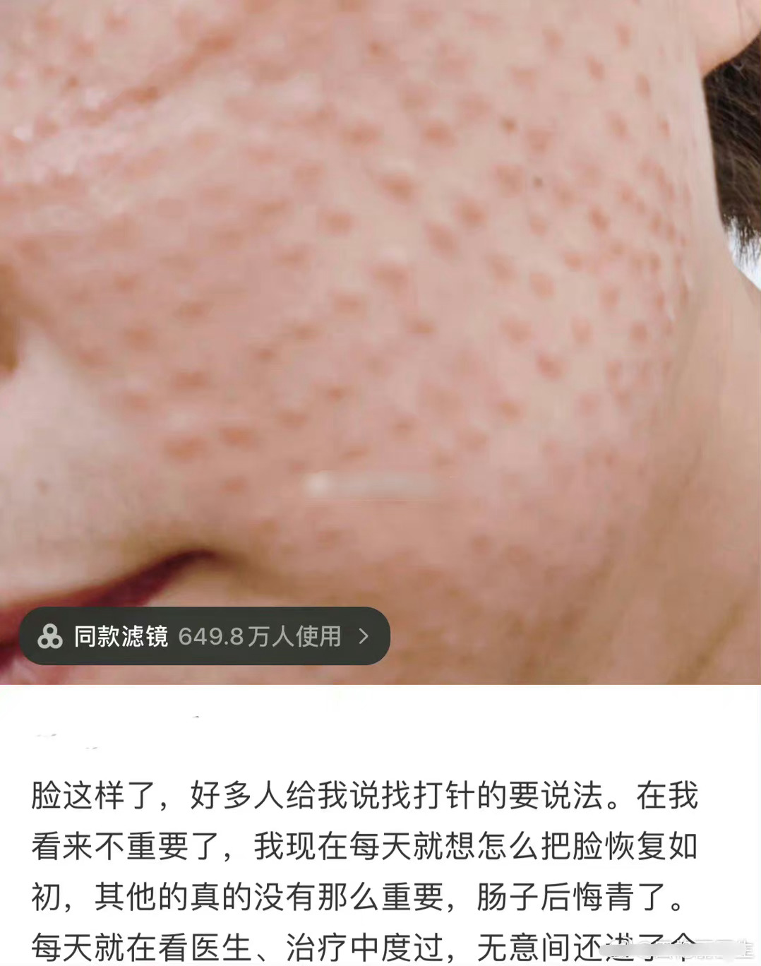 这脸怎么了？据说恢复期以年为单位… ​​​