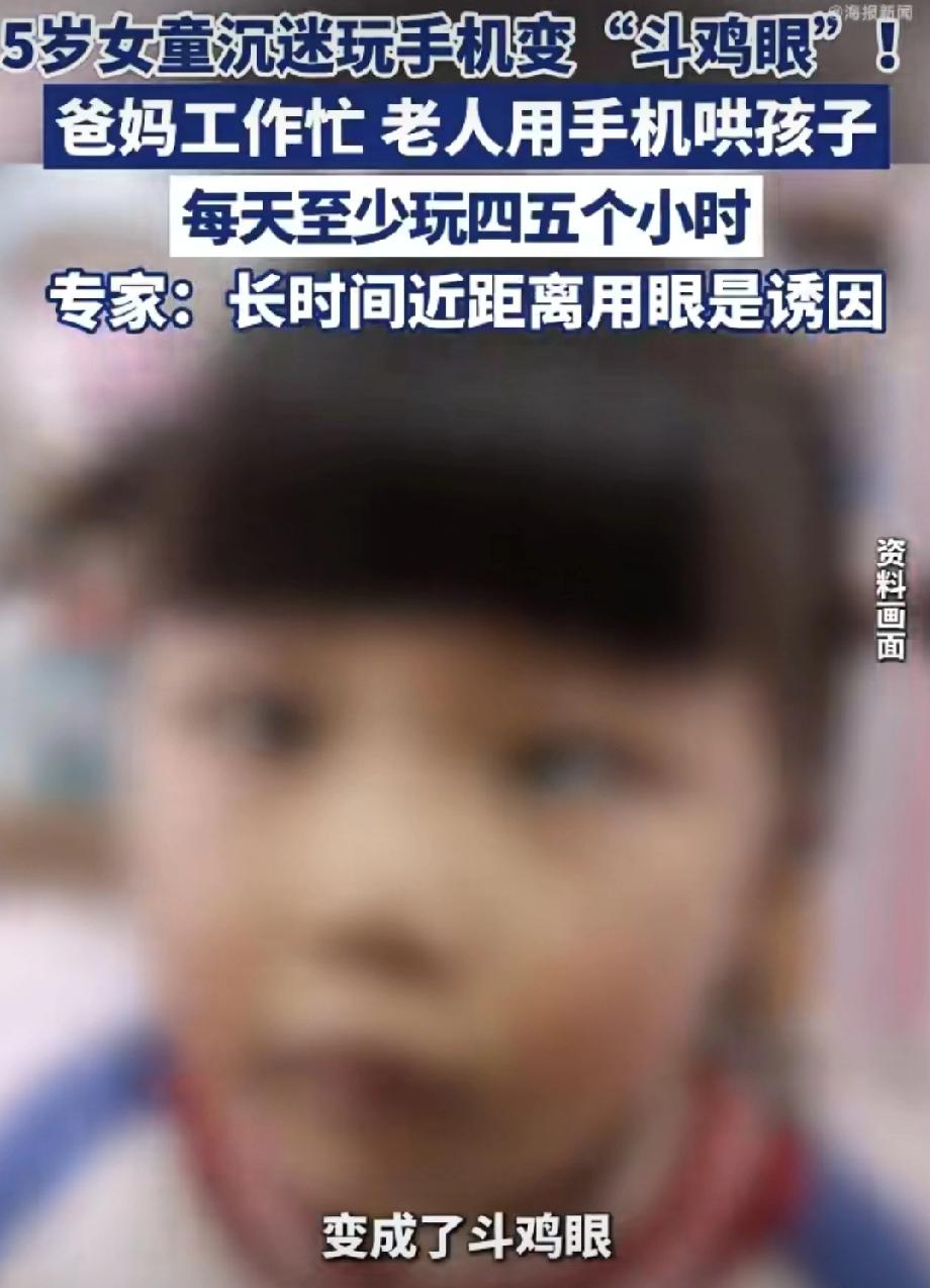 武汉5岁女娃天天抱着手机看，结果看成“斗鸡眼”了……医生一查：急性共同性内斜视！