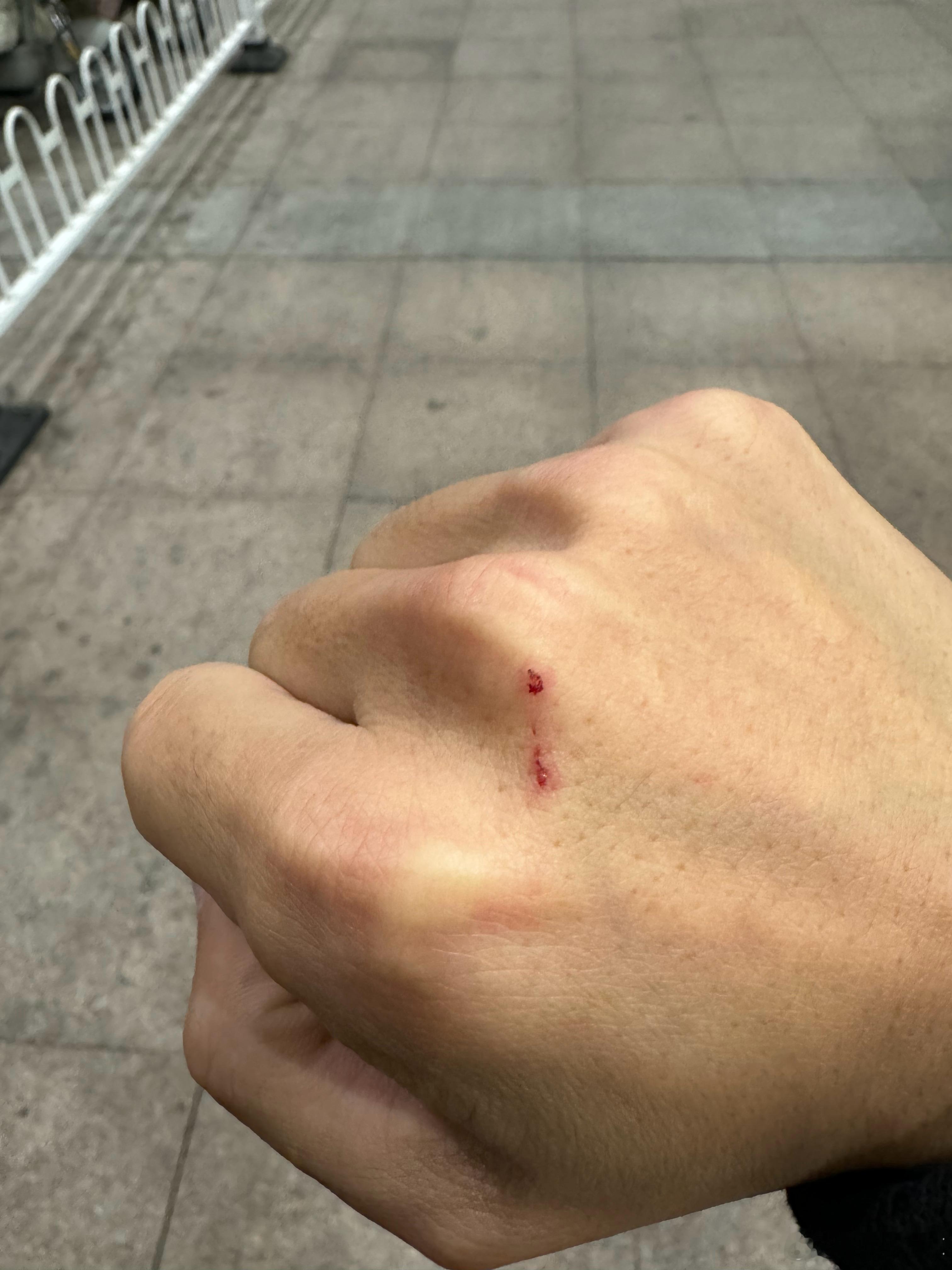 今天被猫抓了我给它预约的美容清洁我把猫笼子拿出来准备装它反正特别快 直接躲起来了