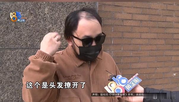 浙江杭州，张先生苦恼于自己的头发，30岁之后就开始有脱发迹象，他想着去外面机构看