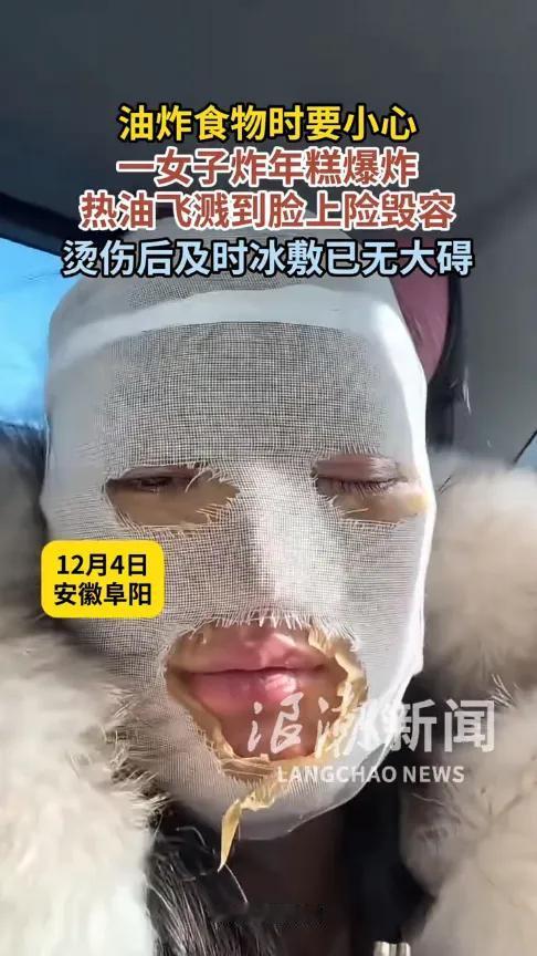 嘴馋炸个年糕竟炸成“毁容风险”！

    安徽女子的遭遇，

     真该给