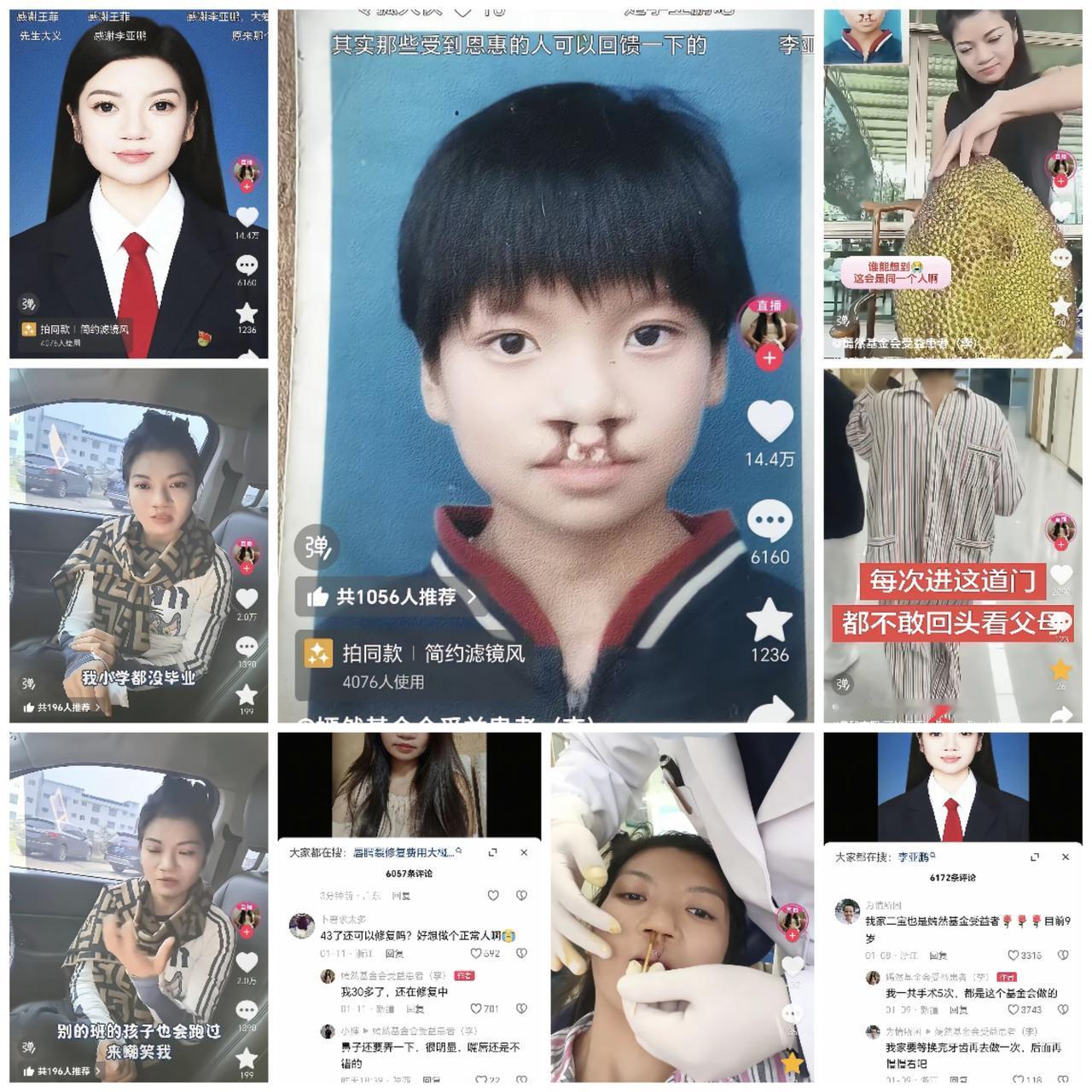 看到李金娜带着那两道鼻侧的浅痕，微笑着宣布收到1300万善款时，我忽然意识到——