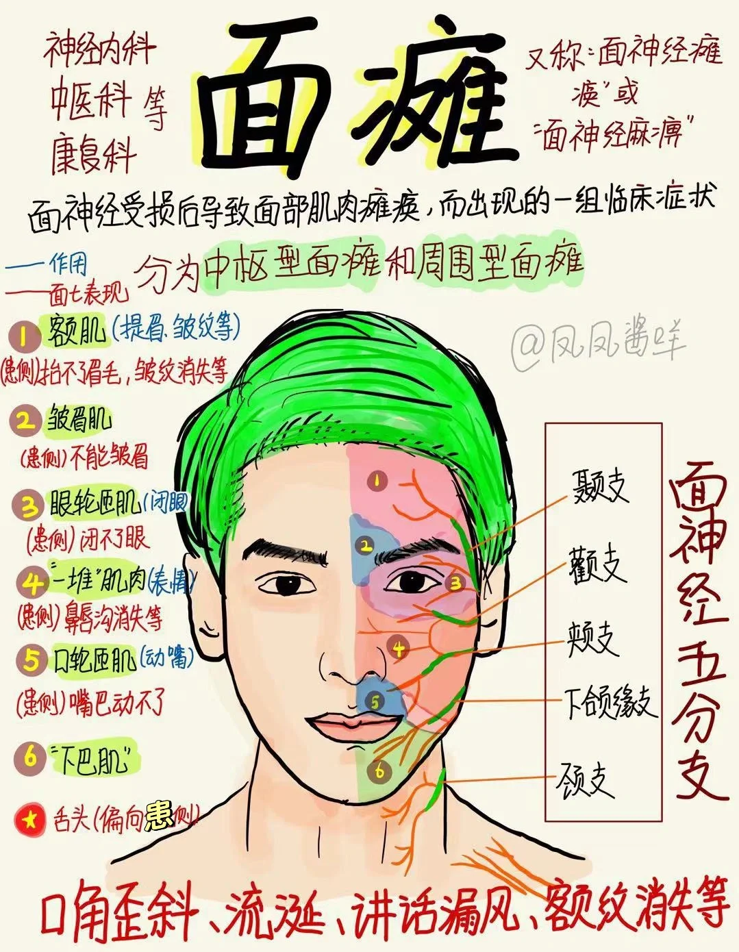 📖 医学生笔记 | 面瘫 建议点赞收藏